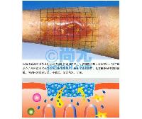 德国进口“德湿舒”水凝胶伤口敷料 点击放大