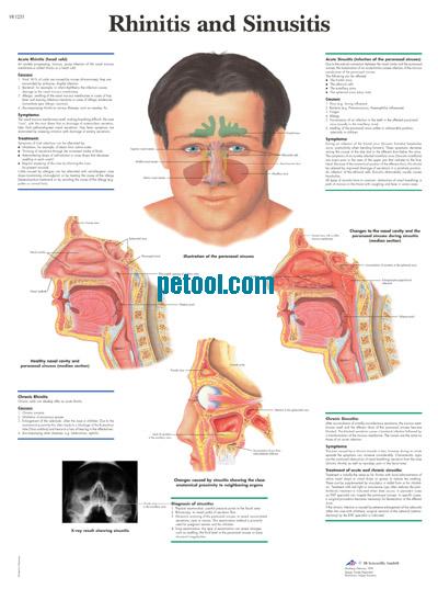 ¹ǺͼRhinitis and Sinusitis 