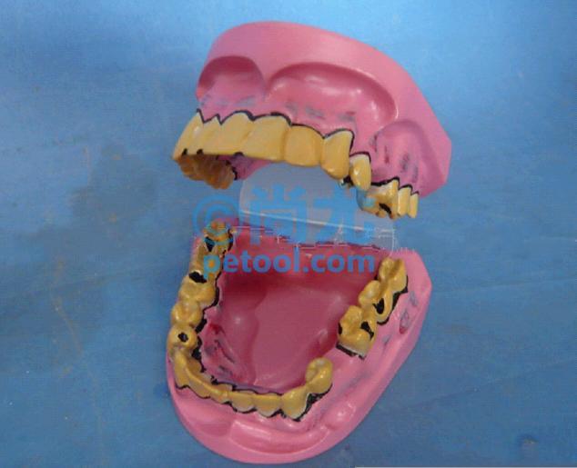 国产病态牙齿口腔模型