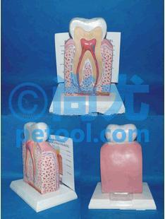 国产健康牙齿解剖面模型